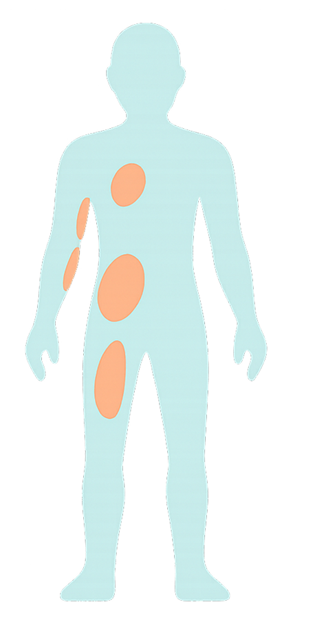 Body Areas